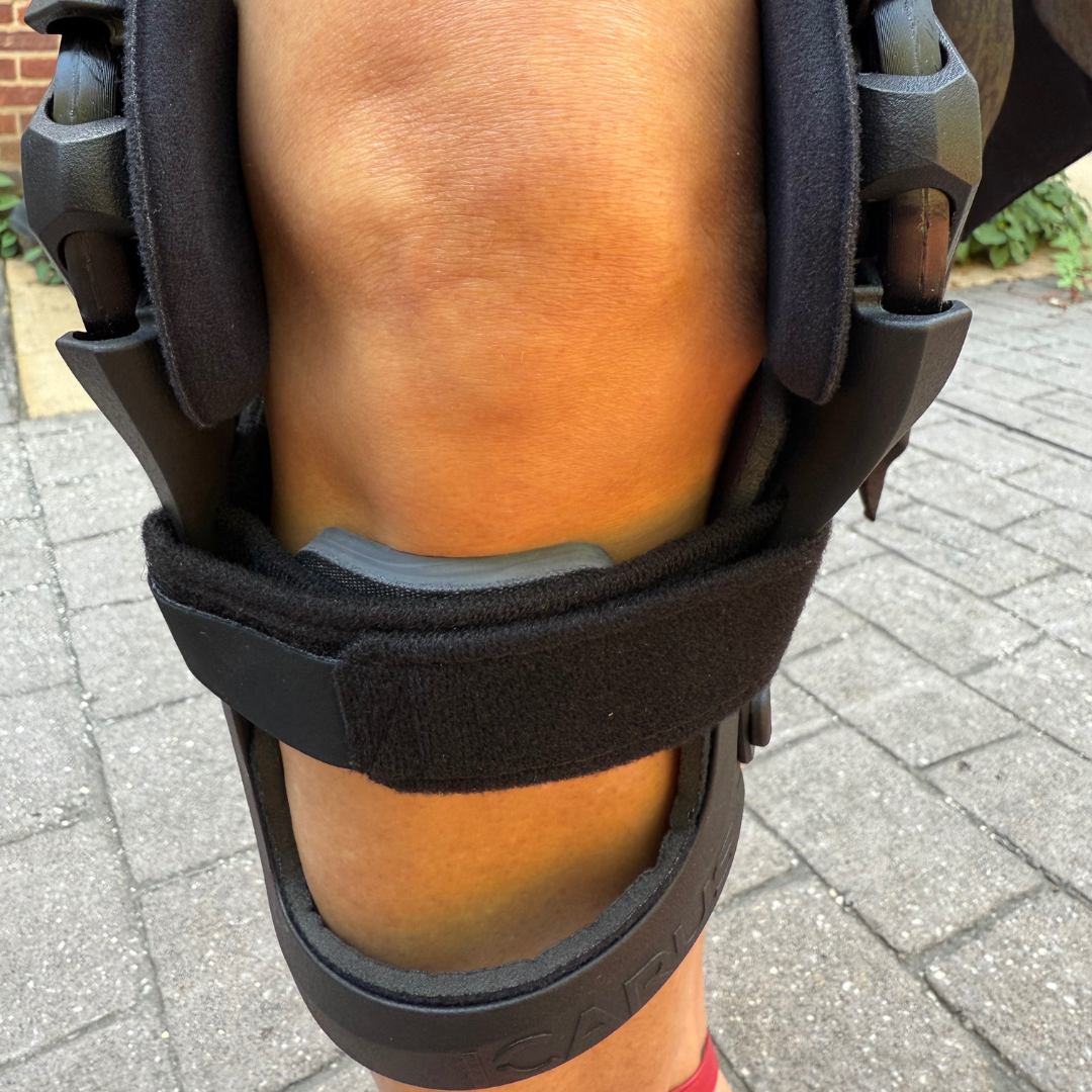Tibial Gel Pad